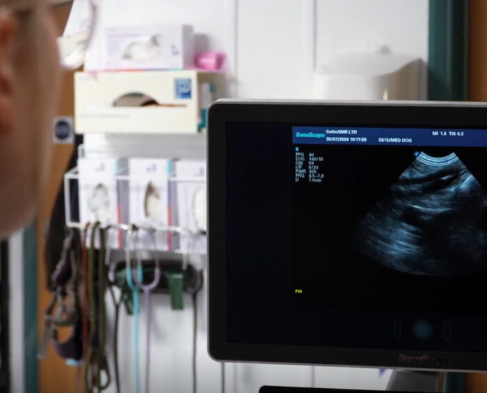 ultrasound